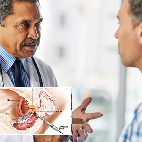 Welcome to   Greater Long Beach Surgery Center 
: Compassionate Care for Penile Implant Troubleshooting